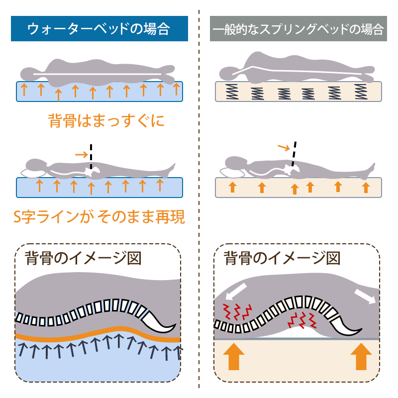 ウォーターベッドと一般的なスプリングベッドの場合