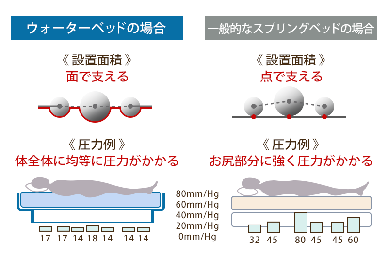 ウォーターベッドと一般的なスプリングベッドの場合